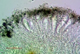 Arthonia pruinata image