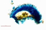 Arthonia pruinata image