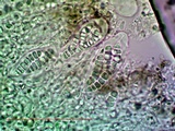Arthonia pruinata image