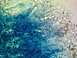 Arthonia pruinata image
