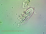 Arthonia pruinata image
