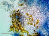 Arthonia pruinata image