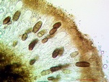 Buellia oidalea image
