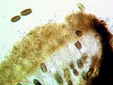 Buellia oidalea image