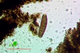 Buellia oidalea image
