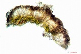 Arthonia cinnabarina image