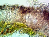 Arthonia cinnabarina image