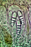 Arthonia cinnabarina image