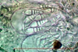 Arthonia cinnabarina image
