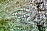 Arthonia cinnabarina image