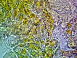 Arthonia cinnabarina image