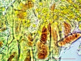 Arthonia cinnabarina image