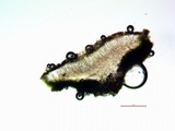 Lecanora albella image