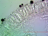 Lecanora albella image