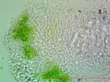 Lecanora albella image
