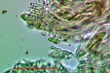 Caloplaca crenulatella image