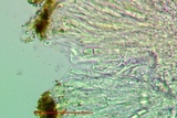 Caloplaca crenulatella image
