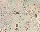 Agaricus placomyces image