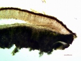 Lobothallia praeradiosa image