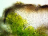 Lobothallia praeradiosa image