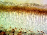 Lobothallia praeradiosa image