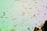 Lobothallia praeradiosa image