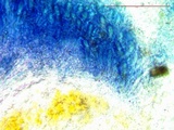 Lobothallia praeradiosa image