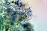 Lobothallia praeradiosa image
