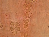 Pluteus petasatus image