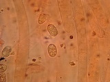 Pluteus petasatus image
