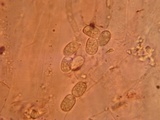 Pluteus petasatus image