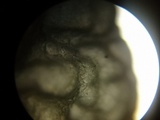 Tetrapyrgos subdendrophora image