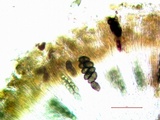 Rinodina capensis image