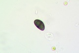 Rinodina capensis image