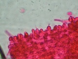 Akanthomyces aranearum image