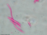 Akanthomyces aranearum image