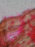 Akanthomyces aranearum image