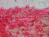 Akanthomyces aranearum image