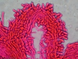 Akanthomyces aranearum image