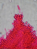 Akanthomyces aranearum image