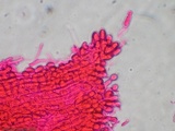 Akanthomyces aranearum image