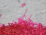 Akanthomyces aranearum image