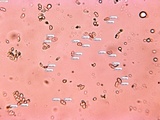 Mycoacia nothofagi image