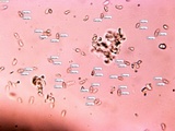 Mycoacia nothofagi image