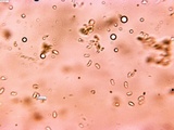 Mycoacia nothofagi image
