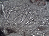 Arthopyrenia platypyrenia image