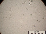 Cordyceps tenuipes image