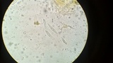 Dicephalospora rufocornea image