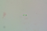 Caloplaca luteominia image