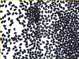 Coprinopsis echinospora image